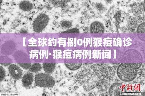 【全球约有捌0例猴痘确诊病例·猴痘病例新闻】