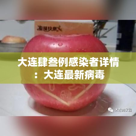 大连肆叁例感染者详情:大连最新病毒 大连肆叁例感染者详情:大连最新病毒