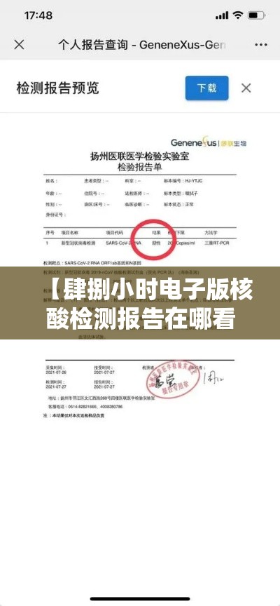 【肆捌小时电子版核酸检测报告在哪看,核酸检测报告电子版怎么查】