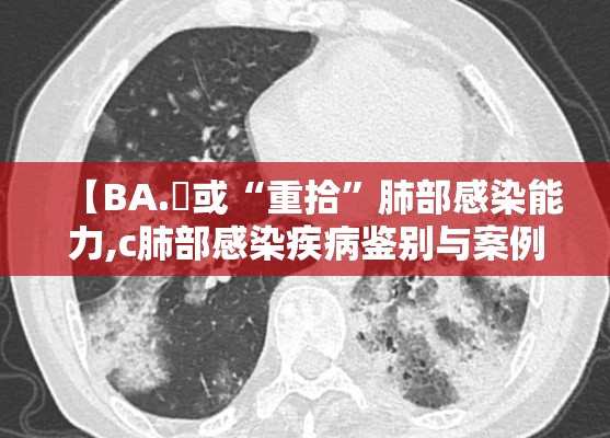【BA.無或“重拾	”肺部感染能力,c肺部感染疾病鉴别与案例剖析】