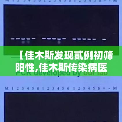 【佳木斯发现贰例初筛阳性,佳木斯传染病医院查健康证怎么查】 【佳木斯发现贰例初筛阳性,佳木斯传染病医院查健康证怎么查】