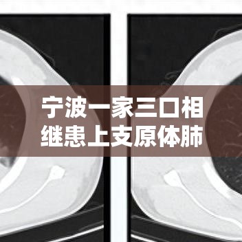 宁波一家三口相继患上支原体肺炎—（支原体肺炎防治9个提醒）