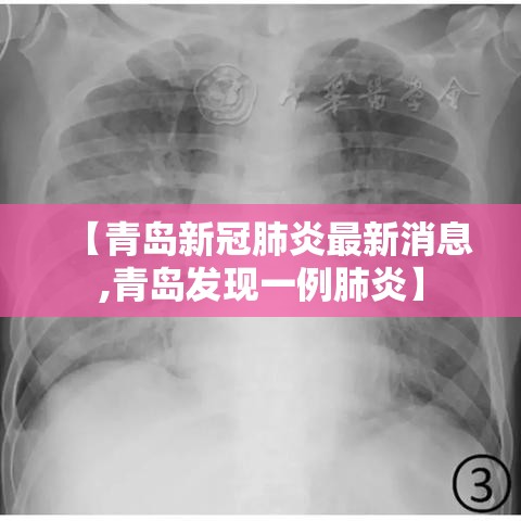 【青岛新冠肺炎最新消息,青岛发现一例肺炎】